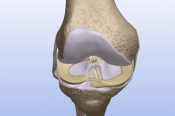 Knee Ali Orthopedics